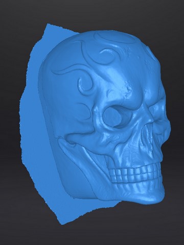Scanner 3D crâne